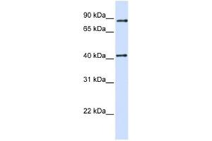 TXNDC13 antibody used at 1 ug/ml to detect target protein. (TMX4 抗体  (C-Term))