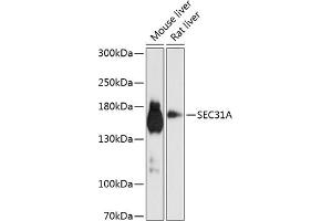 Western blot analysis of extracts of various cell lines, using SEC31A antibody (ABIN6132940, ABIN6147491, ABIN6147492 and ABIN6224974) at 1:1000 dilution. (SEC31A 抗体  (AA 300-500))