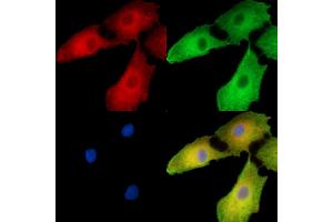 ABIN7096260 and ABIN7100322 staining  cells by IF/ICC. (Ubiquinol-Cytochrome C Reductase Complex Chaperone (UQCC) 抗体)