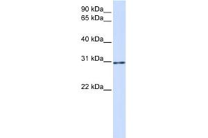 WB Suggested Anti-AKT1S1 Antibody Titration:  0. (PRAS40 抗体  (C-Term))