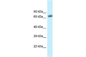 WB Suggested Anti-Btrc Antibody   Titration: 1. (BTRC 抗体  (C-Term))