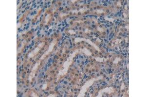 Used in DAB staining on fromalin fixed paraffin- embedded kidney tissue (GBP4 抗体  (AA 1-304))