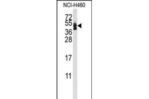 Western blot analysis of anti-CXADR Antibody (Center) (ABIN389372 and ABIN2839469) in NCI- cell line lysates (35 μg/lane). (Coxsackie Adenovirus Receptor 抗体  (AA 132-161))
