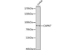 Western blot analysis of extracts of Jurkat cells, using C Rabbit pAb (ABIN7266034) at 1:1000 dilution. (Calpain 7 抗体  (AA 20-220))