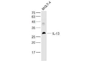 Molt-4 lysates probed with IL-13 Polyclonal Antibody, Unconjugated  at 1:500 dilution and 4˚C overnight incubation. (IL-13 抗体  (AA 45-56))