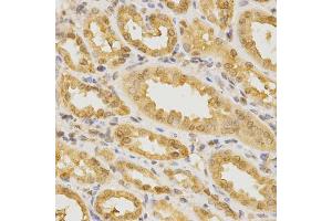 Immunohistochemistry of paraffin-embedded human kidney using CDC42 Antibody (ABIN5970534) at dilution of 1/200 (40x lens). (CDC42 抗体)