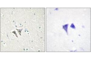 Immunohistochemistry (IHC) image for anti-Activin Receptor Type 1C (ACVR1C) (AA 201-250) antibody (ABIN2889678) (ACVR1C/ALK7 抗体  (AA 201-250))