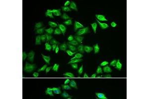 Immunofluorescence analysis of A549 cells using POMGNT2 Polyclonal Antibody (C3orf39 抗体)