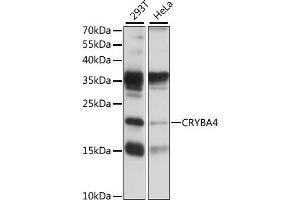 Western blot analysis of extracts of various cell lines, using CRYB antibody (ABIN7266530) at 1:1000 dilution. (CRYbA4 抗体  (AA 1-196))