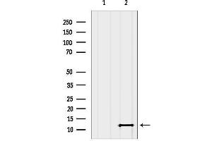 anti-SH3 Domain Binding Glutamic Acid-Rich Protein Like 2 (SH3BGRL2) (Internal Region) antibody