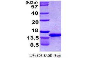 SDS-PAGE (SDS) image for Chemokine (C-C Motif) Ligand 4-Like 1 (CCL4L1) (AA 24-92) protein (His tag) (ABIN666795) (CCL4L1 Protein (AA 24-92) (His tag))