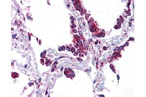 SFTPC antibody was used for immunohistochemistry at a concentration of 4-8 ug/ml. (Surfactant Protein C 抗体  (N-Term))