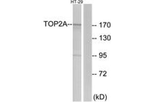 Western blot analysis of extracts from HT-29 cells, using TOP2A Antibody.