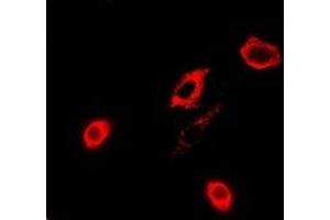 Immunofluorescent analysis of GPx-4 staining in A549 cells. (GPX4 抗体)