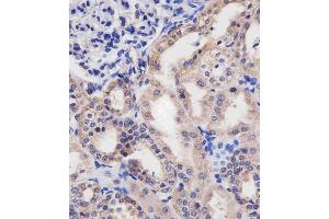 (ABIN655076 and ABIN2844708) staining HTR2B in human kidney tissue sections by Immunohistochemistry (IHC-P - paraformaldehyde-fixed, paraffin-embedded sections). (Serotonin Receptor 2B 抗体  (C-Term))