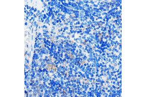 Immunohistochemistry of paraffin-embedded Mouse spleen using HC Rabbit pAb (ABIN7267805) at dilution of 1:100 (40x lens). (GPR109B 抗体)