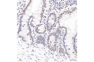 Immunohistochemistry analysis of paraffin-embedded rat colon using,PQBP1 (ABIN7075126) at dilution of 1: 6000