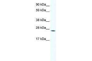 WB Suggested Anti-HOXB7 Antibody Titration:  1. (HOXB7 抗体  (Middle Region))