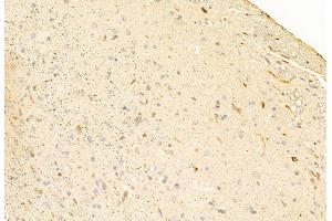 ABIN6262701 and ABIN6269060 at 1/100 staining Mouse brain tissue by IHC-P.
