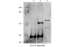 Western Blotting (WB) image for anti-Chaperonin Containing TCP1, Subunit 4 (Delta) (CCT4) (C-Term) antibody (ABIN2775694)