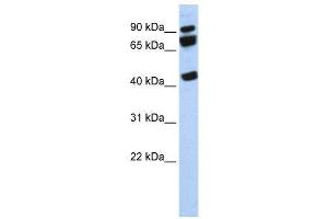 WB Suggested Anti-DDX17  Antibody Titration: 0. (DDX17 抗体  (N-Term))