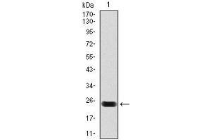 Western blot analysis using troponin T2 mAb against human troponin T2 (AA: 88-249) recombinant protein. (Cardiac Troponin T2 抗体)