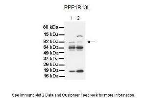 Western Blotting (WB) image for anti-Protein Phosphatase 1, Regulatory Subunit 13 Like (PPP1R13L) (Middle Region) antibody (ABIN2777612)