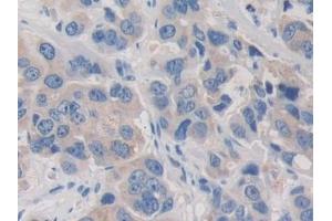 Immunohistochemistry (IHC) image for anti-Pyruvate Dehydrogenase Complex, Component X (PDHX) (AA 220-468) antibody (ABIN7443305)