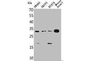 Western Blot analysis of SW480 SKOV3 BT474 mouse heart cells using FGF-18 Polyclonal Antibody (FGF18 抗体  (C-Term))