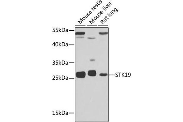 STK19 antibody  (AA 75-364)
