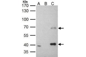 IP Image MSL3L1 antibody immunoprecipitates MSL3L1 protein in IP experiments.