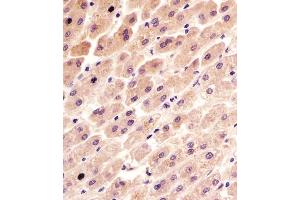 (ABIN6243360 and ABIN6577092) staining FER in human liver tissue sections by Immunohistochemistry (IHC-P - paraformaldehyde-fixed, paraffin-embedded sections). (FER 抗体  (AA 1-300))
