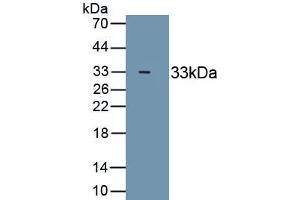 Detection of Recombinant MYH4, Human using Monoclonal Antibody to Myosin Heavy Chain 4, Skeletal Muscle (MYH4) (MYH4 抗体  (AA 1633-1875))
