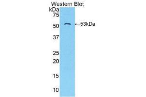 Western Blotting (WB) image for anti-Solute Carrier Family 2 (Facilitated Glucose Transporter), Member 14 (SLC2A14) (AA 51-105) antibody (ABIN1859032) (SLC2A14 抗体  (AA 51-105))