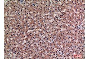 Immunohistochemistry (IHC) analysis of paraffin-embedded Human Liver, antibody was diluted at 1:100. (IGFBPI 抗体  (Internal Region))