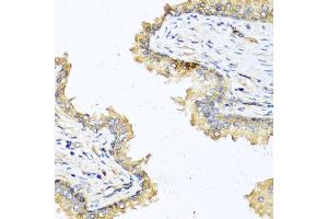 Immunohistochemistry of paraffin-embedded human prostate using DEFB121 antibody (ABIN5970550) at dilution of 1/100 (40x lens). (DEFB121 抗体)
