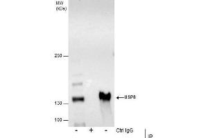 IP Image Immunoprecipitation of USP8 protein from HCT-116 whole cell extracts using 5 μg of USP8 antibody, Western blot analysis was performed using USP8 antibody, EasyBlot anti-Rabbit IgG  was used as a secondary reagent. (USP8 抗体)
