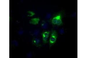 Image no. 2 for anti-Lipase, Endothelial (LIPG) antibody (ABIN1499165) (LIPG 抗体)