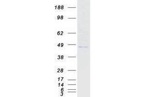Western Blotting (WB) image for Nuclear Transcription Factor Y, gamma (NFYC) (Transcript Variant 2) protein (Myc-DYKDDDDK Tag) (ABIN2727239)