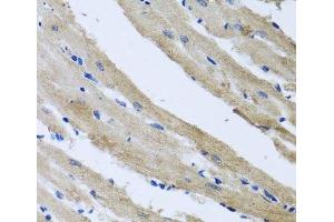 Immunohistochemistry of paraffin-embedded Rat heart using ST8SIA2 Polyclonal Antibody at dilution of 1:100 (40x lens). (ST8SIA2 抗体)
