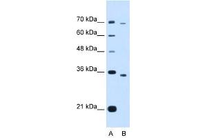 PHF6 antibody (20R-1278) used at 0. (PHF6 抗体  (Middle Region))
