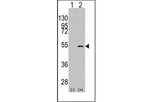 Image no. 1 for anti-Elongator complex protein 3 (ELP3) (C-Term) antibody (ABIN356662) (ELP3/KAT9 抗体  (C-Term))