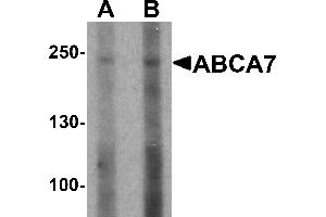 Western blot analysis of ABCA7 in 293 cell lysate with ABCA7 antibody at (A) 1 and (B) 2 µg/mL. (ABCA7 抗体  (N-Term))