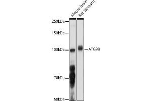 Western blot analysis of extracts of various cell lines, using B antibody (ABIN6133279, ABIN6137271, ABIN6137272 and ABIN6223276) at 1:1000 dilution. (ATG9B 抗体  (AA 715-924))