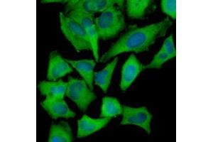 Immunofluorescence of human HeLa cells stained with Hoechst 33342 (Blue) and monoclonal anti-Hexokinase antibody (1:1000) with Alexa 488 (Green). (Hexokinase 1 抗体)