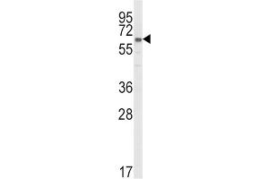 Western Blotting (WB) image for anti-Cytochrome P450, Family 51, Subfamily A, Polypeptide 1 (CYP51A1) antibody (ABIN3003944)