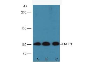 Lane A: Mouse testis lysates Lane B: Mouse kidney lysates Lane C: Mouse pancreas lysates. (ENPP1 抗体  (AA 41-140))
