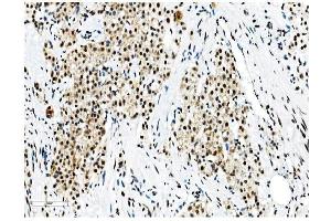 IHC analysis of NRF1 using anti-NRF1 antibody (ABIN7600874).