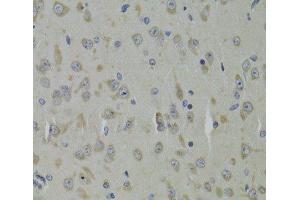 Immunohistochemistry of paraffin-embedded Mouse brain using RPL9 Polyclonal Antibody at dilution of 1:100 (40x lens). (RPL9 抗体)