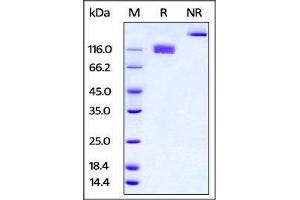 SDS-PAGE (SDS) image for Colony Stimulating Factor 1 Receptor (CSF1R) (AA 20-511) (Active) protein (Fc Tag) (ABIN4949181)